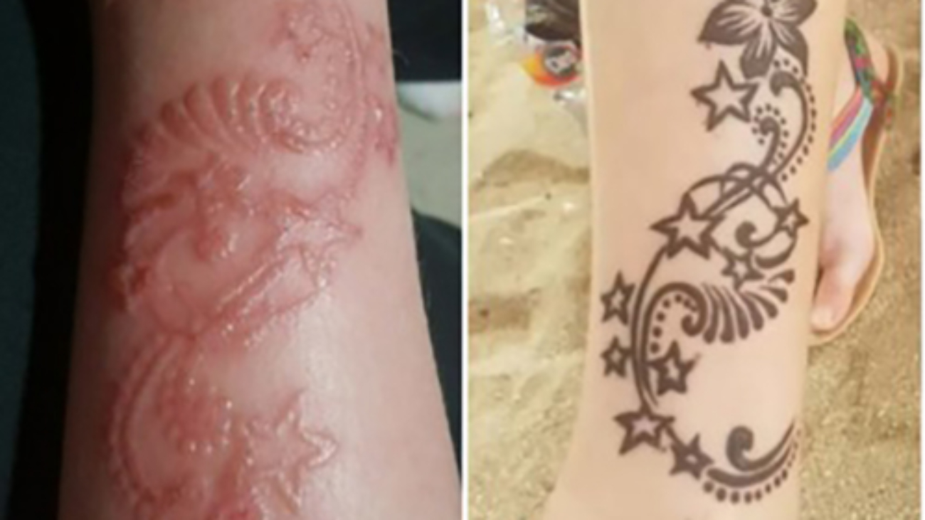 How Dangerous Can Black Henna Be-13.2x11.3-13.2x11.3